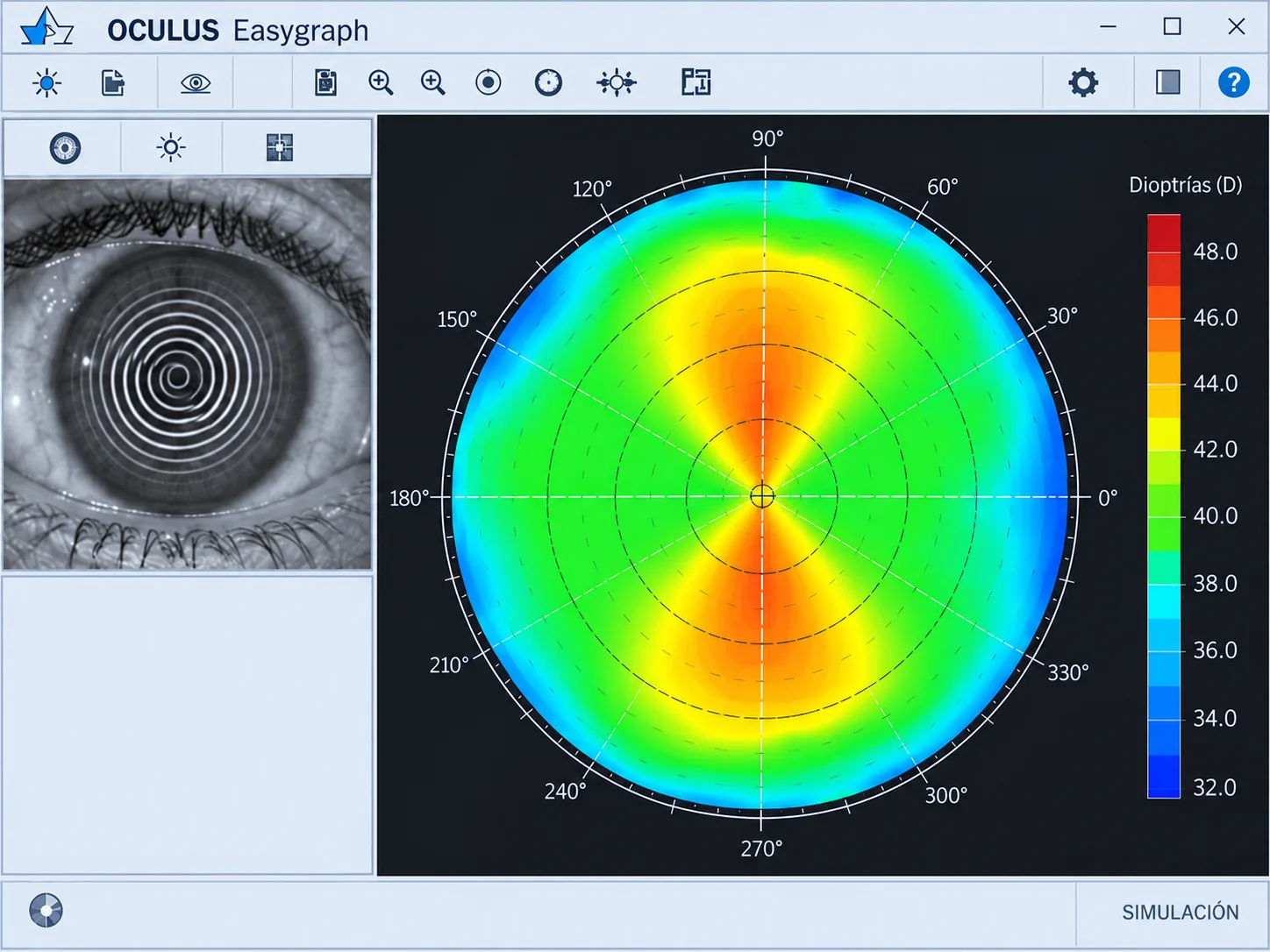 Simulación de topografía corneal Oculus Easygraph